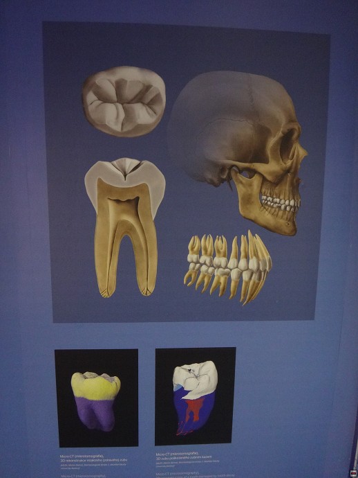 img00030.jpg